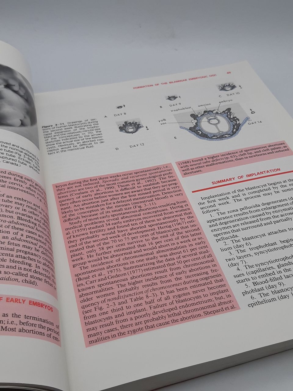 4P86 The Developing human. Clinically oriented Embriology. Moore and Persaud, 1993 год, USA